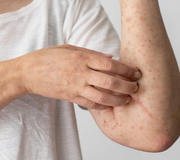 حساسیت‌های احتمالی مرتبط با گز و پولکی | گز و شیرینی آریا (بهترین گز اصفهان)